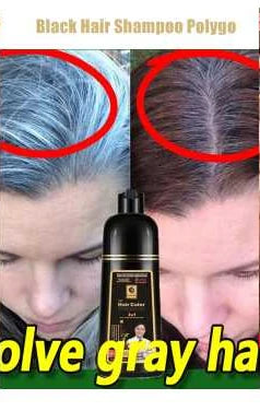 Hair Growth Products Prevent Hair Loss Essential Oil Fast Growing Anti-Drying Scalp Treatment Repair Beauty Health for Men Women