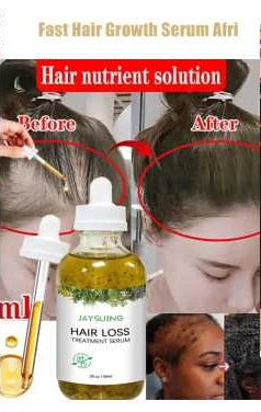 Hair Growth Products Prevent Hair Loss Essential Oil Fast Growing Anti-Drying Scalp Treatment Repair Beauty Health for Men Women