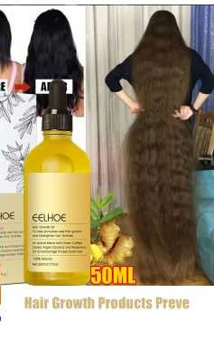 Hair Growth Products Prevent Hair Loss Essential Oil Fast Growing Anti-Drying Scalp Treatment Repair Beauty Health for Men Women